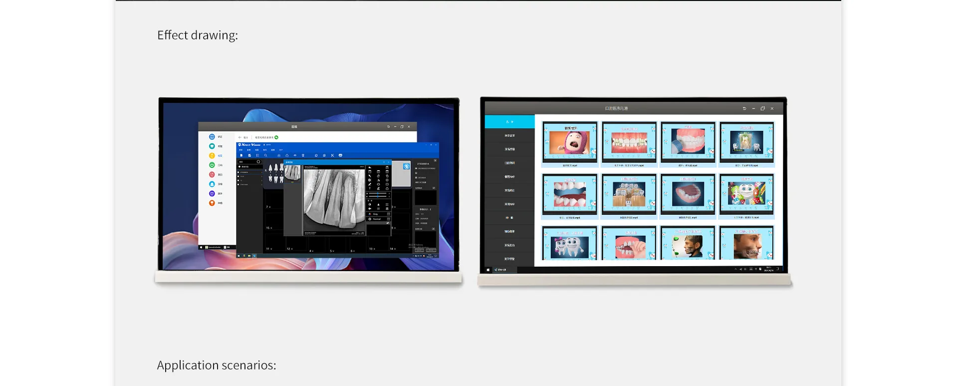 22 Inch Intraoral camera all in one PC 4 22电脑机 05