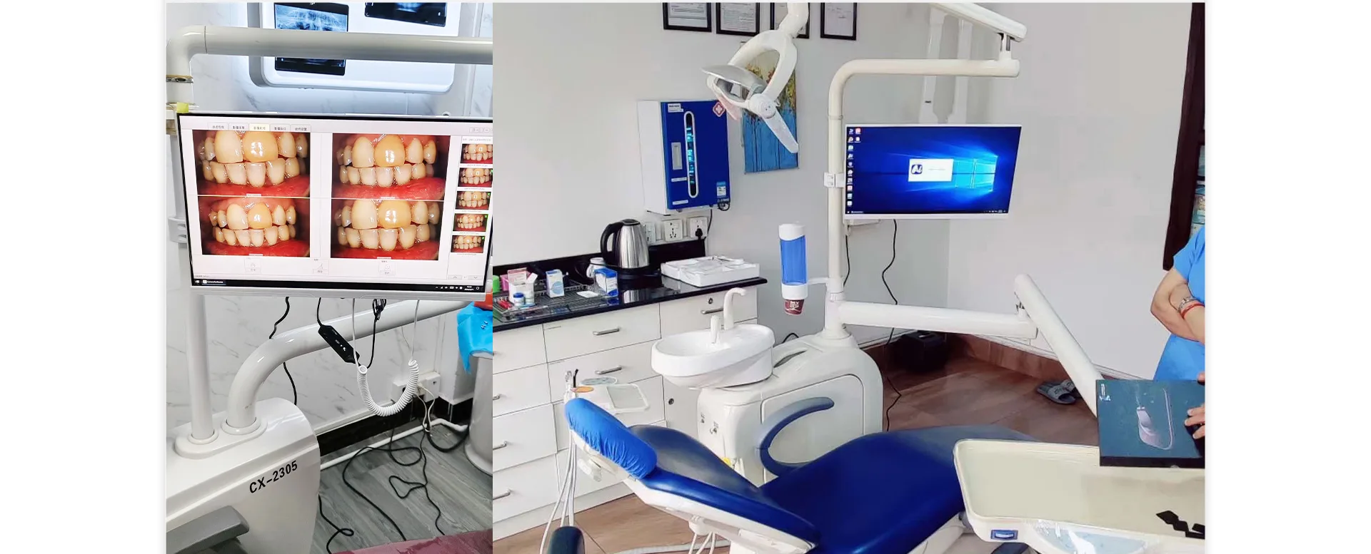 22 Inch Intraoral camera all in one PC 5 22电脑机 06