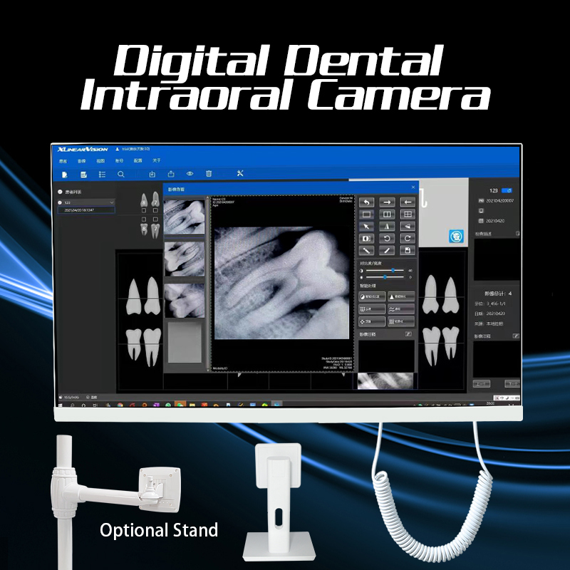 Dental Oral Scanner PC