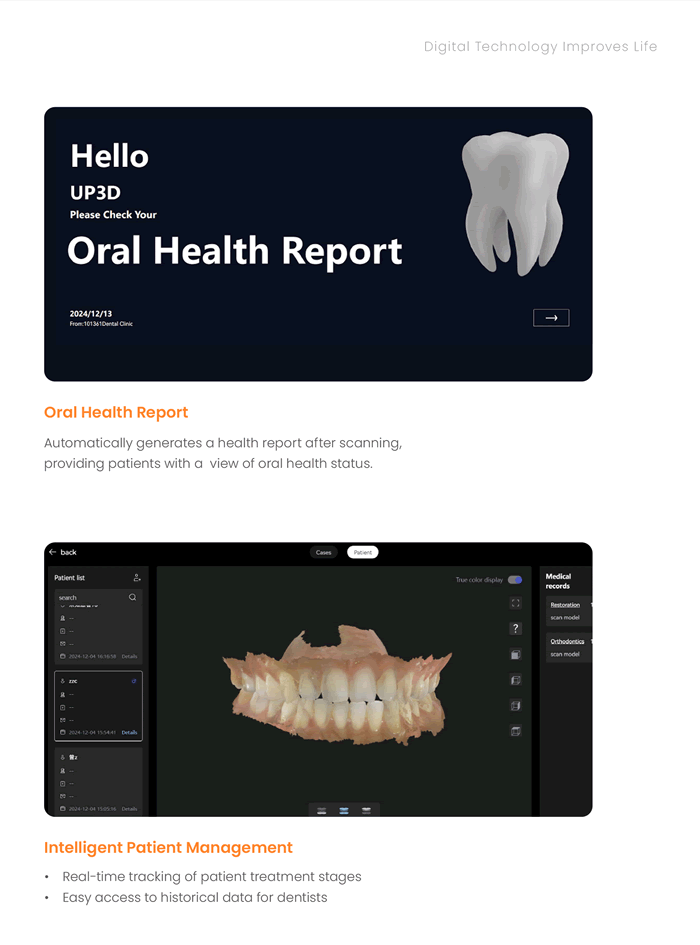 Intraoral Scanner high precision,rapid scanning 10 Dental scanning equipment 10