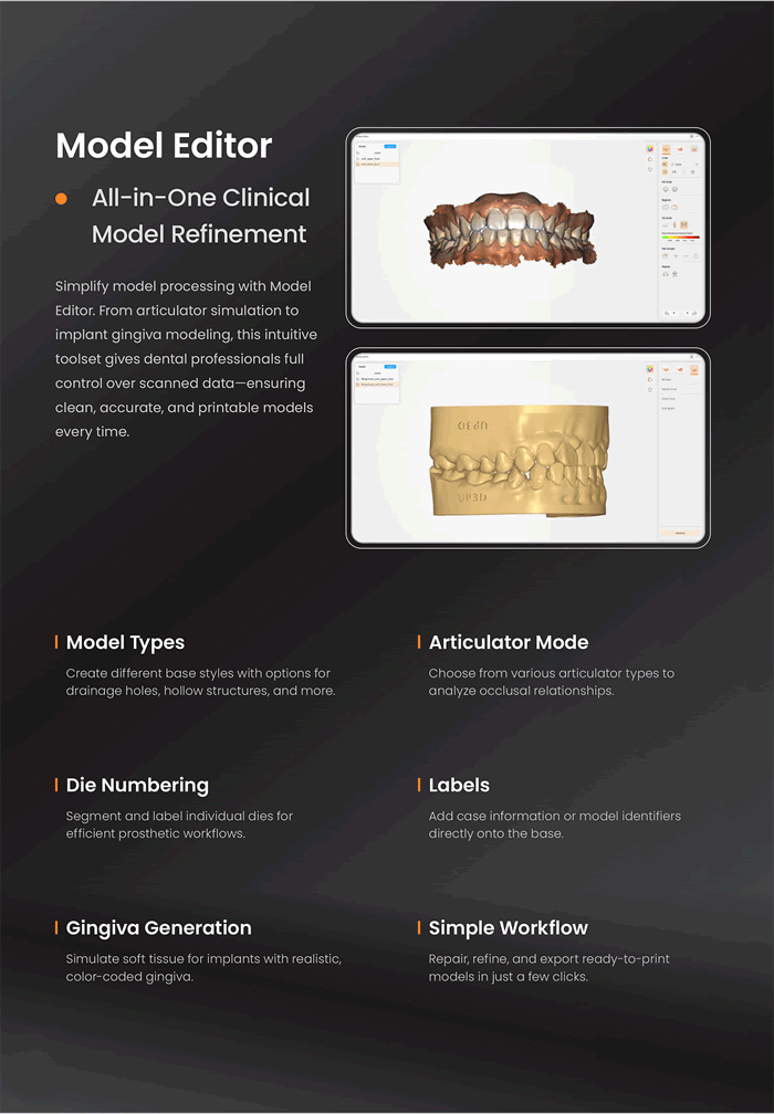 Intraoral Scanner high precision,rapid scanning 13 Dental scanning equipment 13