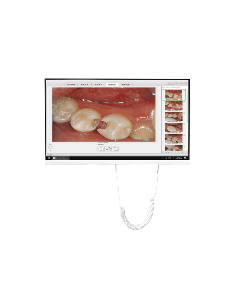 HOM 24-Inch Dental Oral Scanner Computer