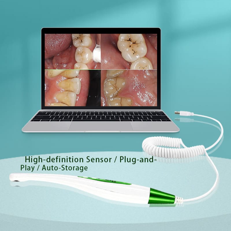 USB dental intraoral camera for dental clinic_2